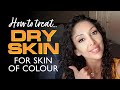 DOCTOR V How to treat DRY SKIN for Skin of Colour | Brown/ Dark skincare | Dull skin