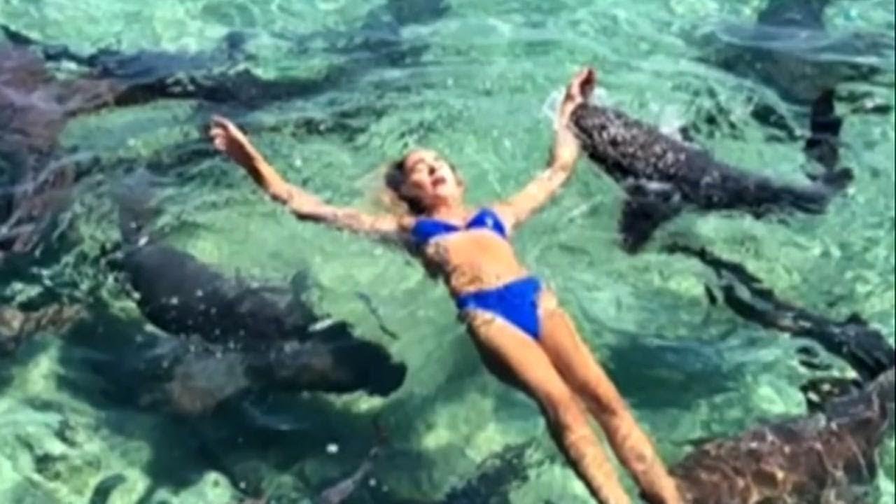 Instagram model recovering after shark bite in the Bahamas