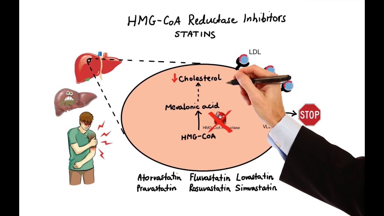 Pharmacology - DRUGS FOR HYPERLIPIDEMIA (MADE EASY) - YouTube