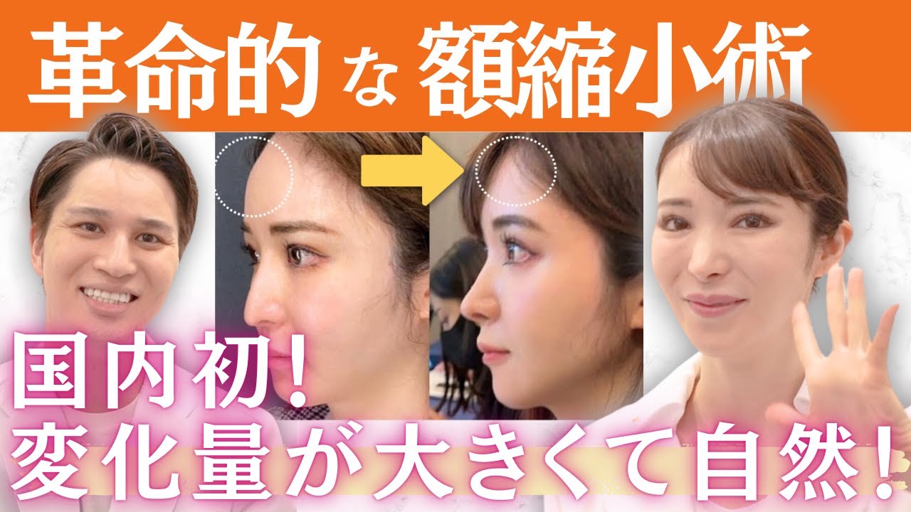 Forehead reduction] A beauty-obsessed director explains the face