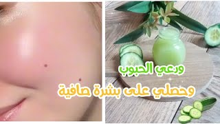 ماسك ضد الحبوب سهل جدا /علاج  حبوب الوجه وتصفية البشرة بسرعة homemade cucumber night cream