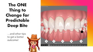 Invisalign ClinCheck - The 1 Thing to do for Deep Bite predictability