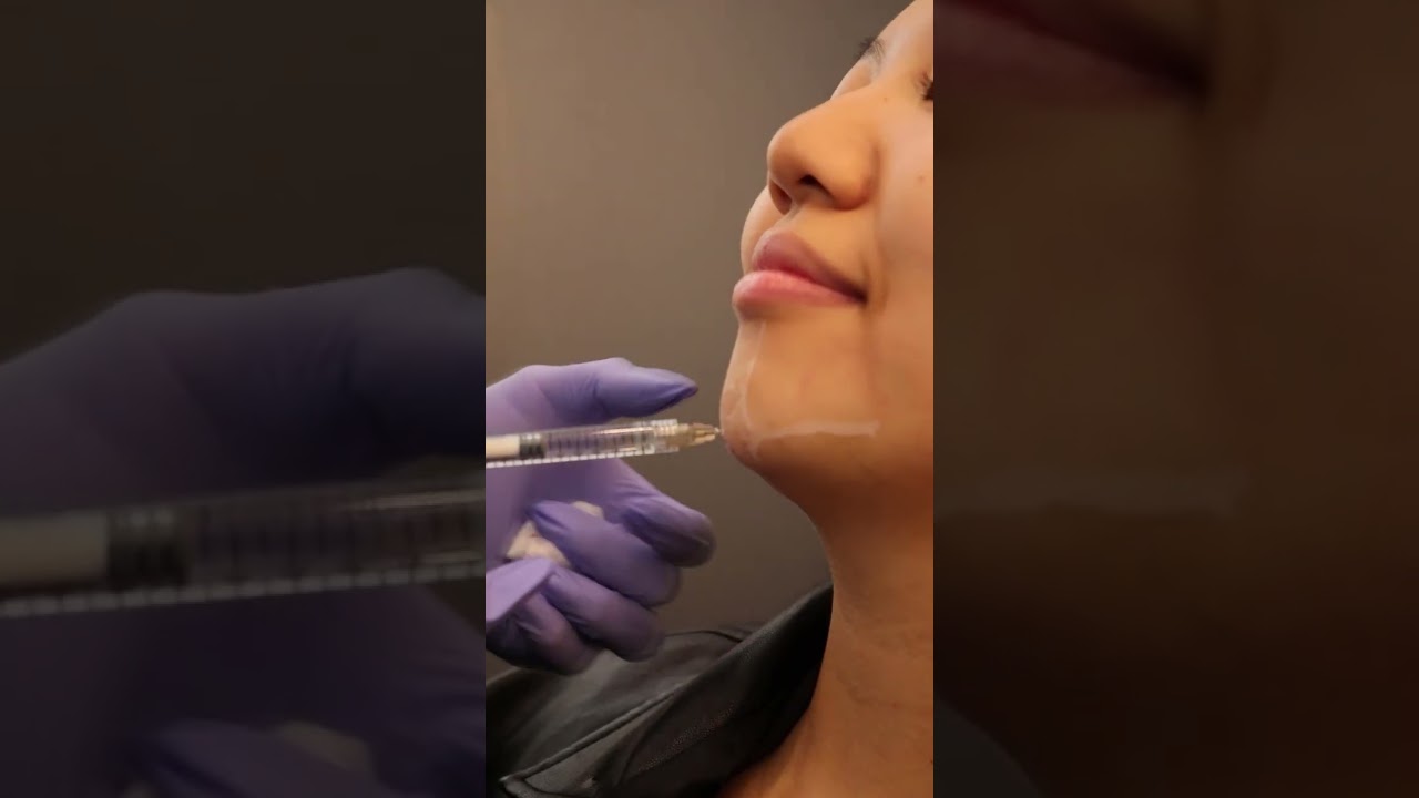 Get Your Dream Side Profile!