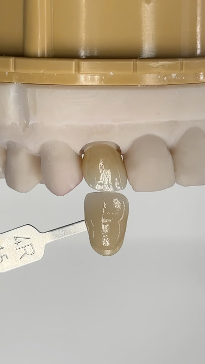 Fantastically Shaded Incisor #lsk121shorts #dentist #teeth