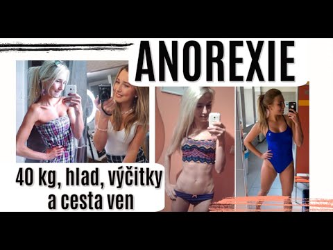 Video: Anorexie. Ztráta Hmotnosti Nemůže Zemřít