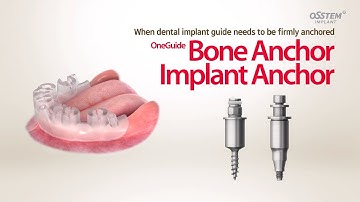 Anchors the OneGuide in place and prevents the OneGuide from shaking “OneGuide Vertical Anchor”