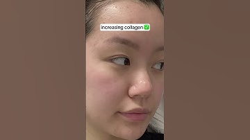 All the benefits you love about red-light therapy!‼️ #skincareroutine #redlight #beauty #travel