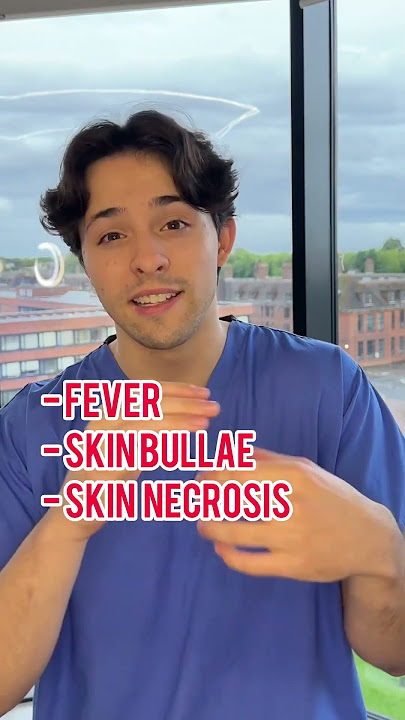 Stevens-Johnson syndrome (SJS) #doctor #mbbs #medicalstudent #sjs #usmle #medicine