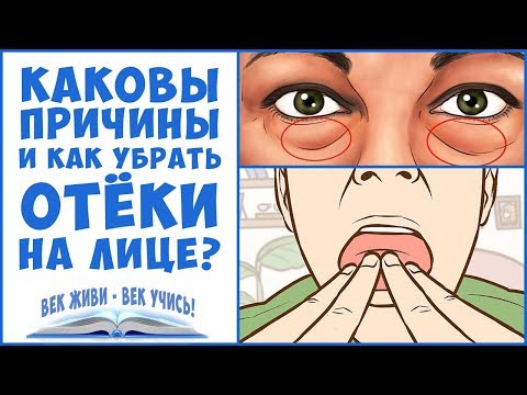 ОТЁКИ. Отёки ЛИЦА. Как убрать отёки на лице. Задержка воды. Вены. Лимфа.