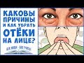 ОТЁКИ. Отёки ЛИЦА. Как убрать отёки на лице. Задержка воды. Вены. Лимфа.