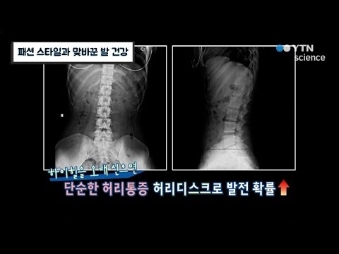 패션 스타일과 맞바꾼 발 건강 / YTN 사이언스