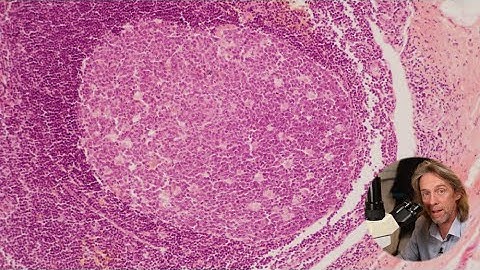 Histologie van de appendix