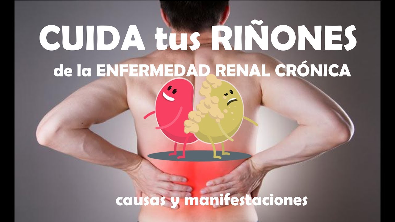 Enfermedad Renal Crónica - Causas y síntomas - YouTube