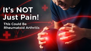 The Hidden Warning Behind Your Joint Pain | Don’t Ignore These Early Signs of Rheumatoid Arthritis!"