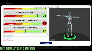 Kinetisense's Functional Planar Mapping