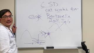 Bartonella neuroretinitis (cat scratch disease)