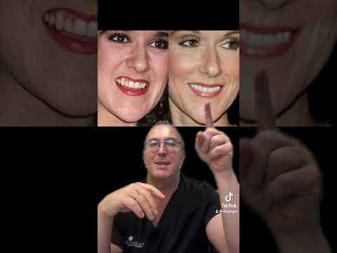 Video thumbnail: Did Celine Dion get a Rhinoplasty? · The Spiegel Center