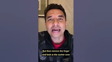 A Simple Inexpensive Effective Remedy For Canker Sores 