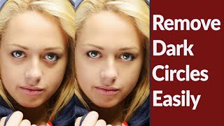 Remove dark circles easily in photoshop tutorial
