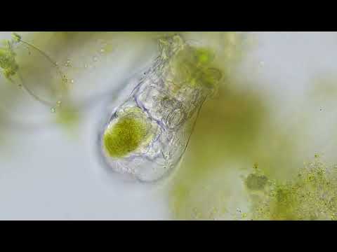 @accu-scope EXC-350 viewing a rotifer with an Excelis 4k camera.