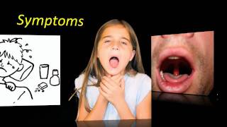 Uvulitis