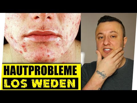 Video: So waschen Sie Ihr Gesicht, wenn Sie eine empfindliche Haut haben – wikiHow