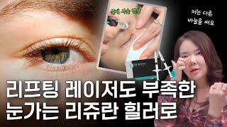 눈가에 리쥬란 힐러를 놓는 이유