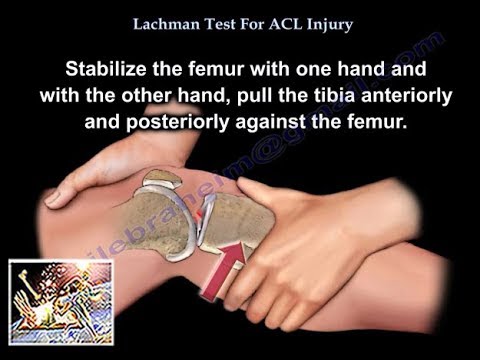 Lachman Test ACL Injury - Everything You Need To Know - Dr. Nabil Ebraheim