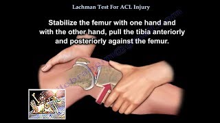 Lachman Test ACL Injury - Everything You Need To Know - Dr. Nabil Ebraheim