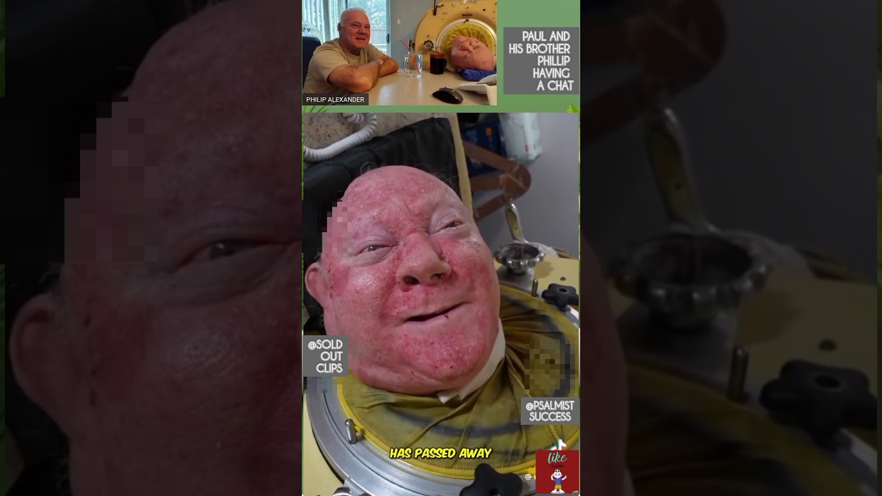 Man lived with an IRON Lung 