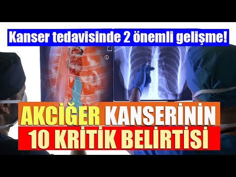 AKCİĞER KANSERİNİN 10 BELİRTİSİ! Akciğer kanseri tedavisinde 2 önemli gelişme...