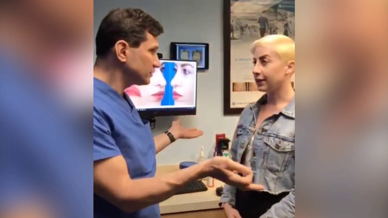 Rhinoplasty Experience 1 Week Post Operation in New York City