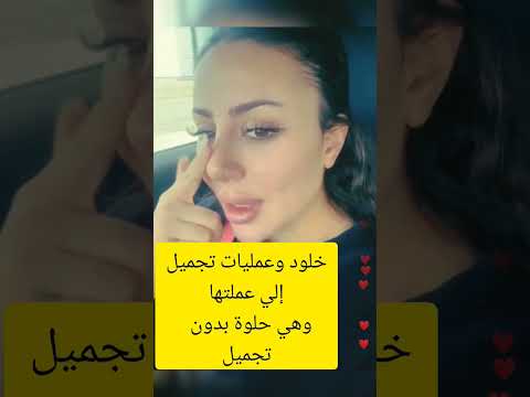 بكل جرأة وصدق خلود اللبنانية تكشف تفاصيل عمليات التجميل التي خضعت لها