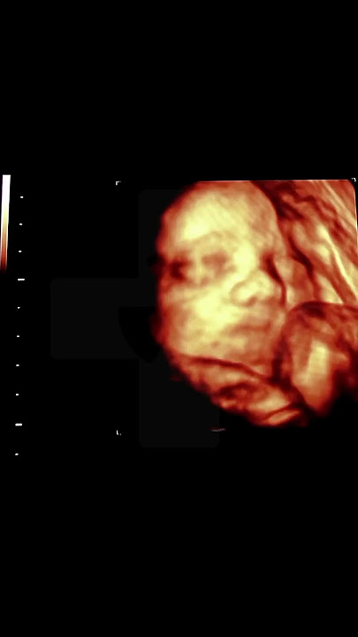 Baby Smiling During Ultrasound Will Make Your Heart Melt #amazing #baby #science #shorts
