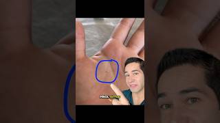 Doctor Explains: pencil tattoo?