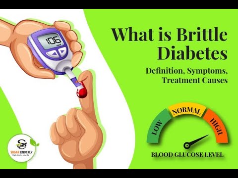 What is Brittle Diabetes: Definition, Symptoms, Treatment Causes