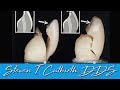 How to Make Your Veneers as Strong as Teeth - Dental Minute with Dr. Steven T. Cutbirth, DDS