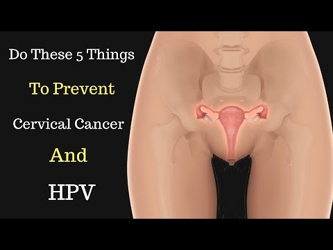 How to Keep Your Cervix Healthy With Natural Remedies