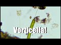 Astounding Microscopic Vorticella feeding on other protists