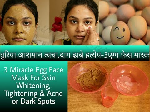 Skin Whitening Egg Face Mask | SkinTightening | Remove Acne & Dark Spots