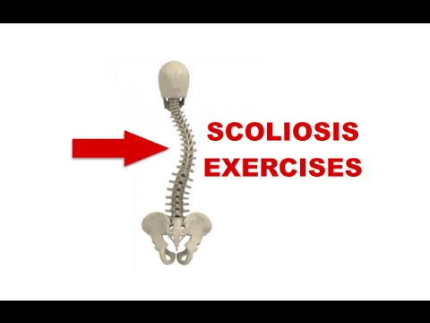 atlanta-chiropractor---scoliosis-exercises-and-stretches---car-accident-doctor-atlanta