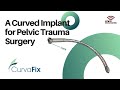 Curvafix  pelvic trauma curved implant