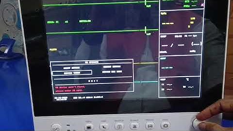 CONTEC CMS8000 ( NEW ) DEMO VIDEO