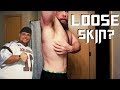 Loose skin after weight loss without surgery 160 lb transformation