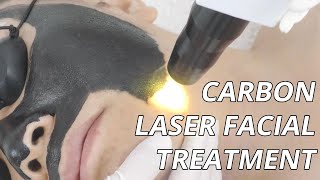 Can This Carbon Laser Facial Treat Melasma? Carbon Laser Peel (How It Works) screenshot 2