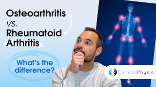 Osteoarthritis vs. Rheumatoid Arthritis | What's the Difference?