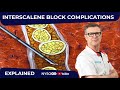 The Role of Fascia in Interscalene Plexus & other NB Complications - Crash course with Dr. Hadzic