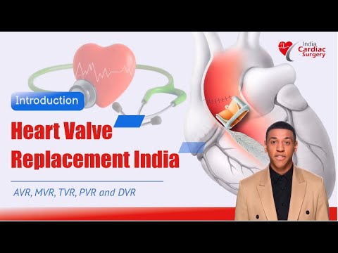Plan Your Heart Valve Replacement Surgery in India - India Cardiac ...