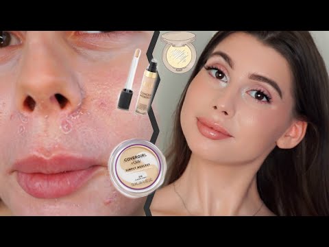 COVERING DRY, FLAKY AND ACNE PRONE SKIN || DRUGSTORE ONLY MAKEUP ROUTINE 202!