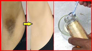 Homemade Whiten Underarms Recipe | DIY for Armpits | Dr Heng Soy